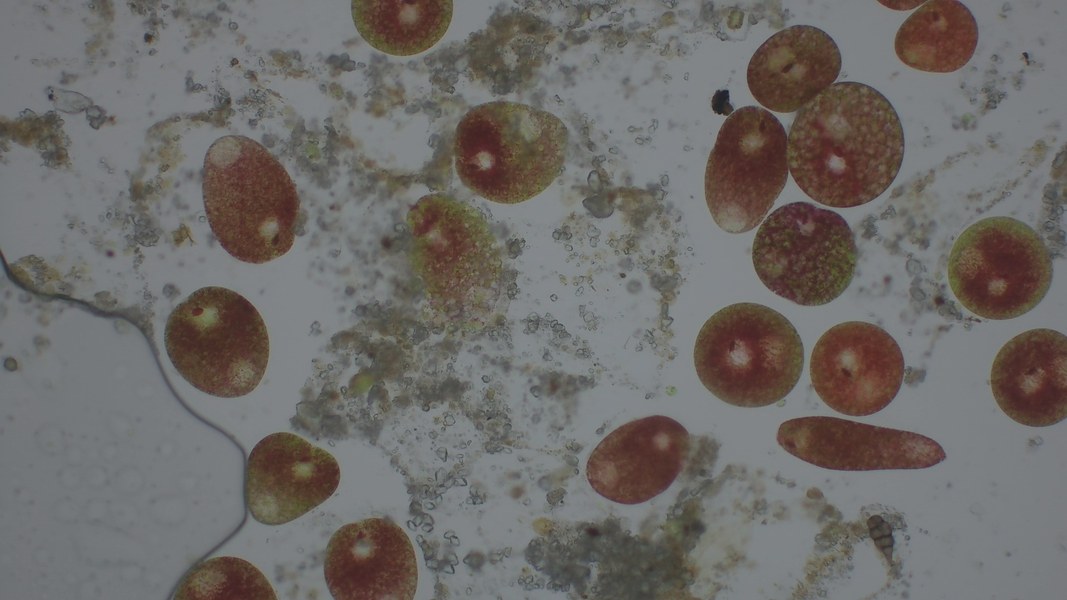 Immagine microscopio fioritura algale