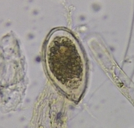 Alga Ostreopsis ovata