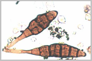 Alternaria