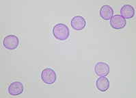 polline broussonetia.jpg
